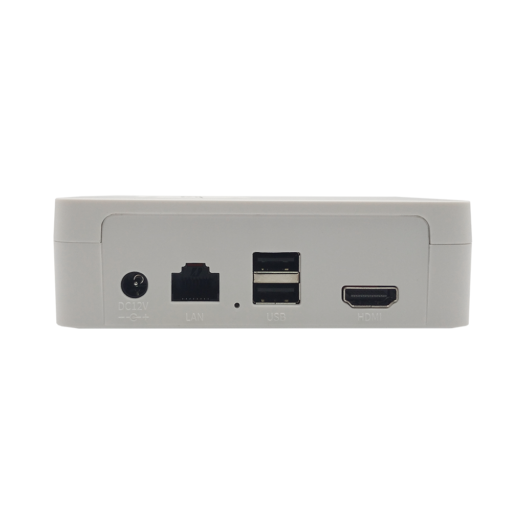 ST-NVR-S0405K15 TOWN
